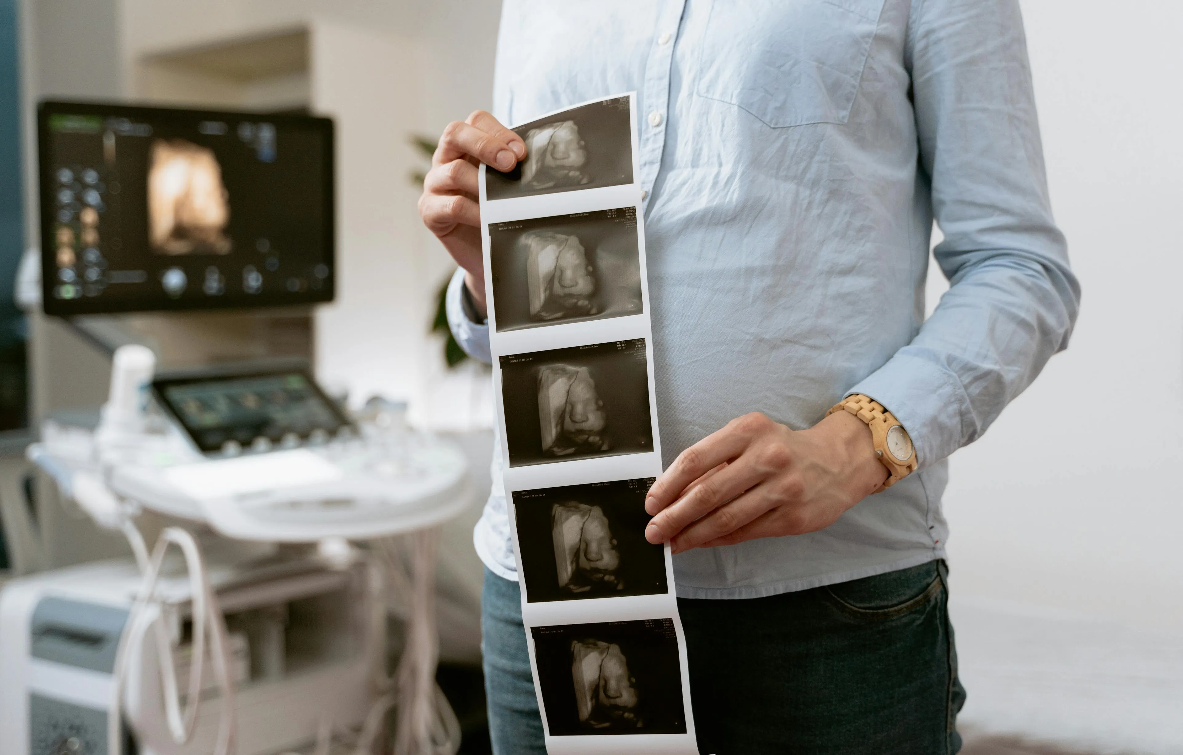 Hamilelikte Ay Ay Dikkat Edilmesi Gerekenler Nelerdir?