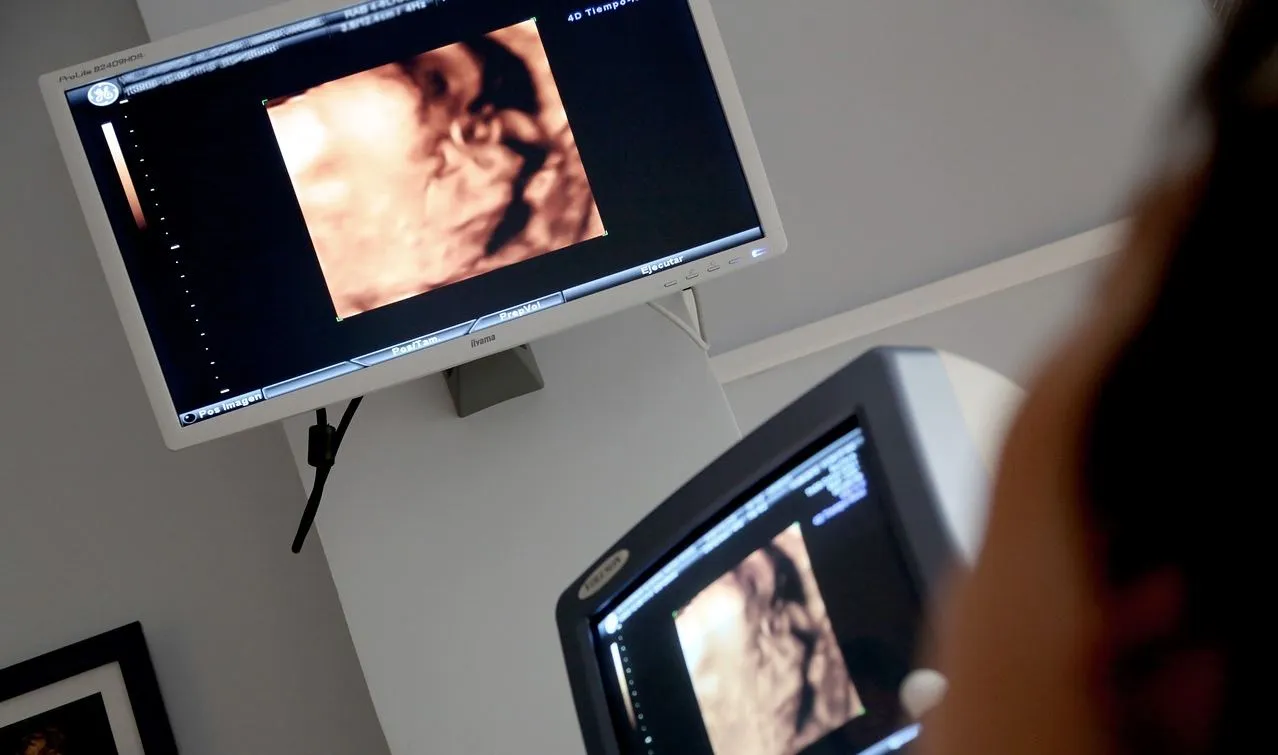 renkli ultrason nedir